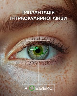 Имплантация интраокулярной линзы
