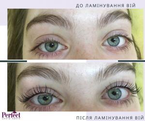 ЛАМІНУВАННЯ ВІЙ