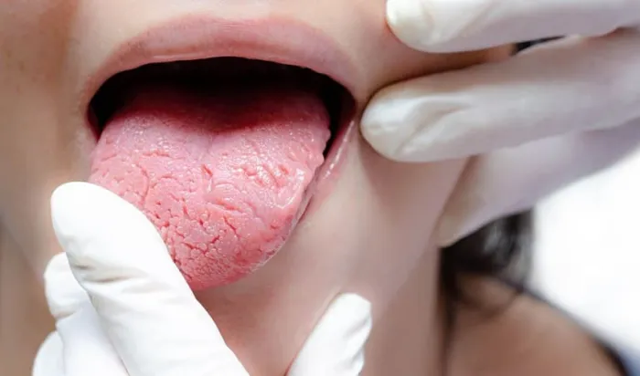 Почему болит язык со стороны: топ частых причин и что делать?