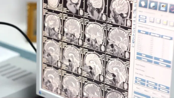 Когда можно делать МРТ после операции?